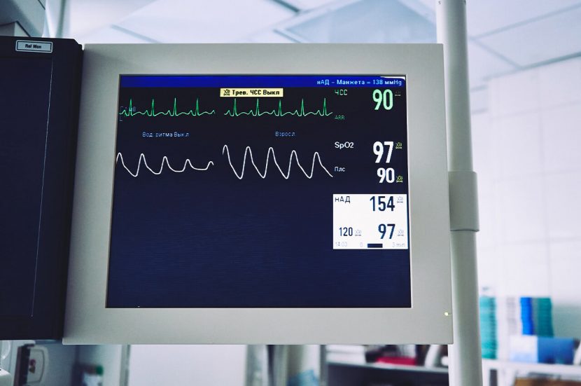 Wat is de hartslagvariabiliteit (HRV)?